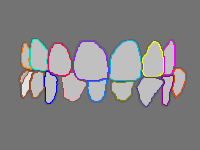 Annotation Visualization